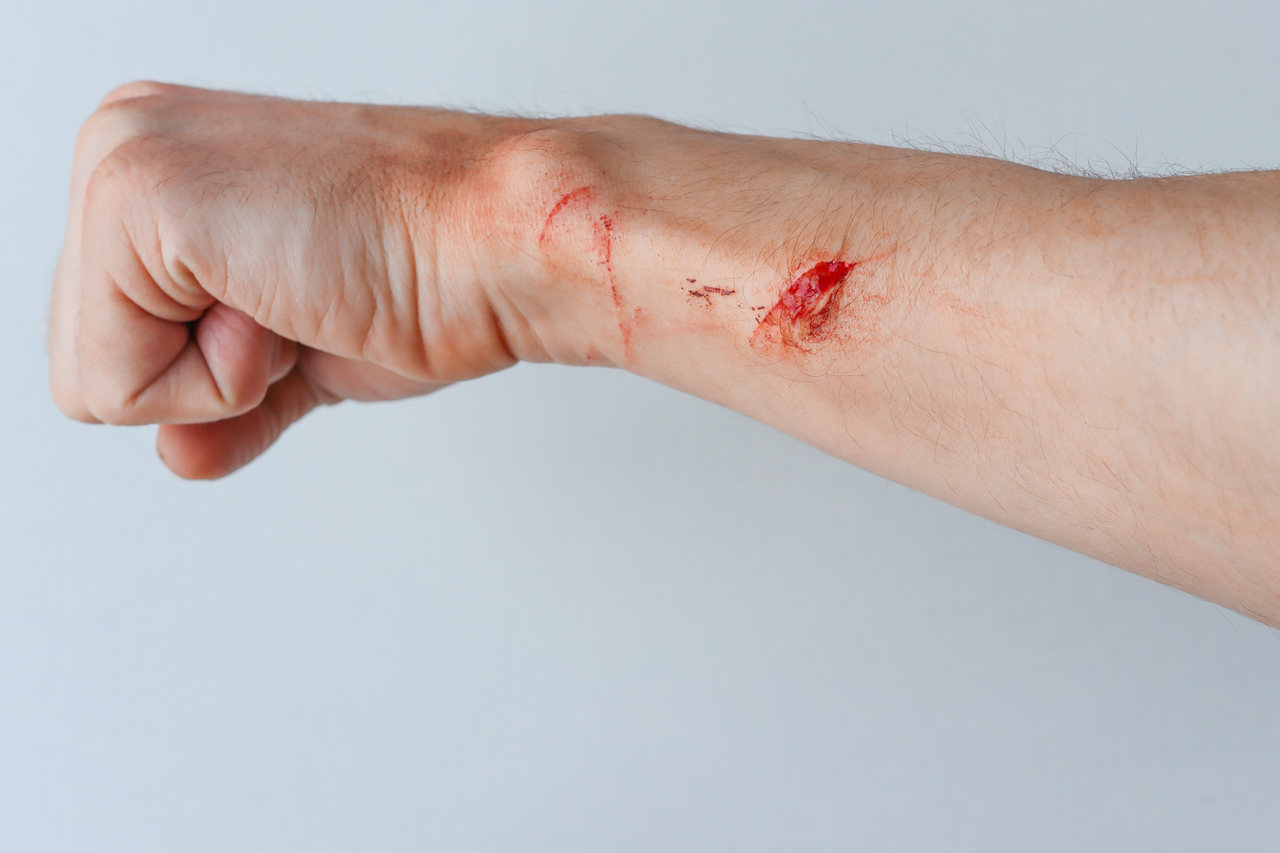 Tipos de tecidos encontrados em uma lesão